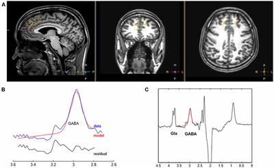 Low Prefrontal GABA Levels Are Associated With Poor Cognitive Functions in Professional Boxers